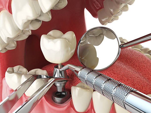Best Emergency Dental Care for Broken or Chipped Teeth in Panama, OK